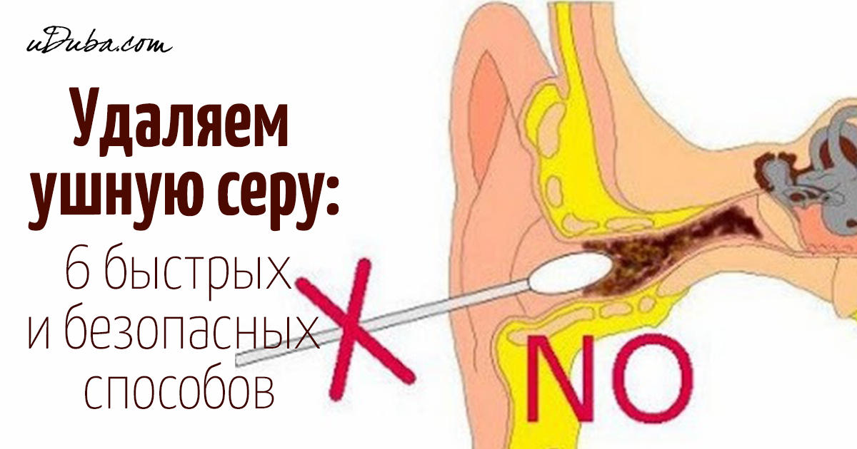 Сера в ушах убрать в домашних условиях