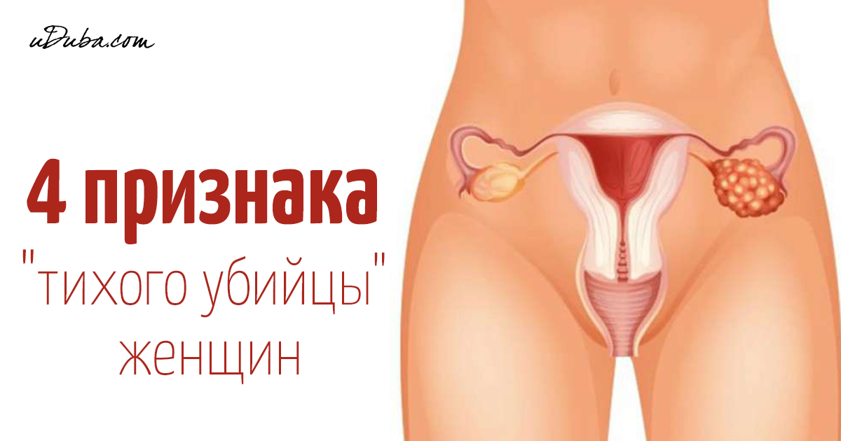 Рак половых губ картинки