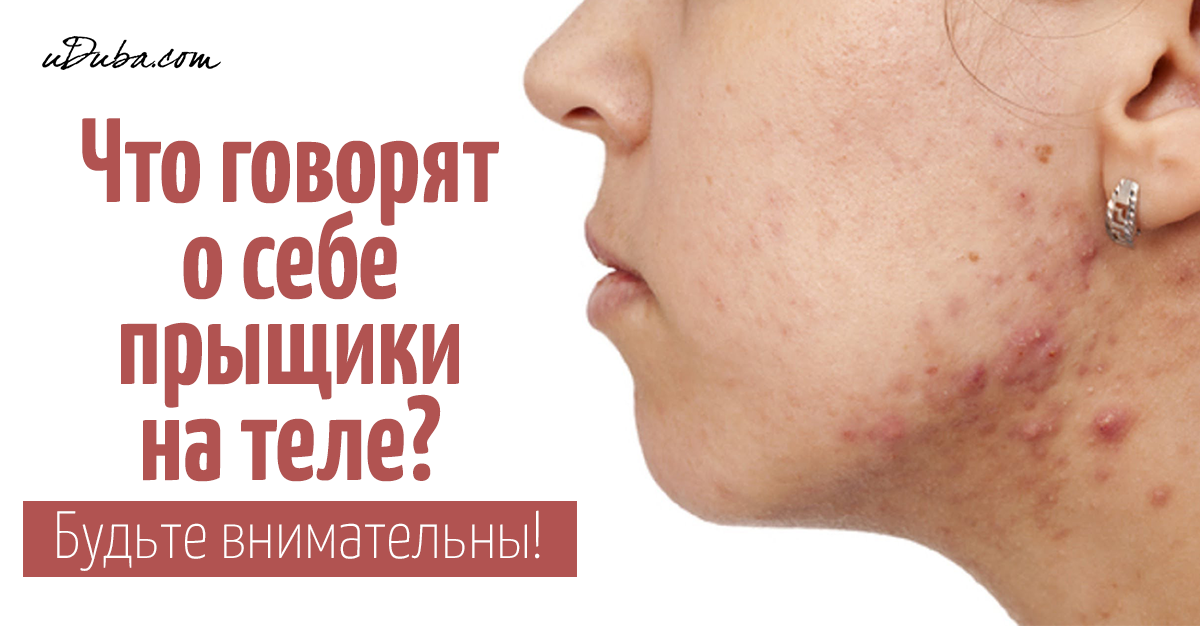 О чем говорит высыпания на теле О чем говорит высыпания на теле